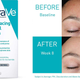 Image for article titled Treat Your Beautiful Skin to the Best Products for Hyperpigmentation